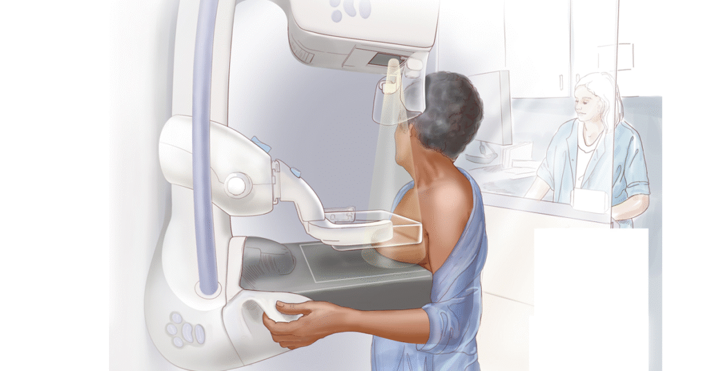 Kwanini wanawake wengi huchelewa kugundulika na kuanza matibabu ya saratani ya matiti? breastfeaturedimage